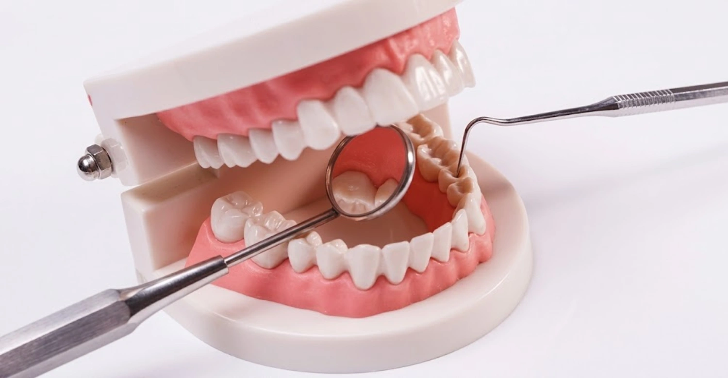 dental check up 2